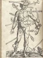Field book of surgery. The wounded man