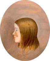 Portrait of a Girl with a Birth Mark