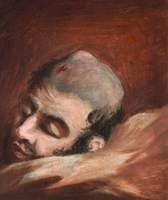 The Wounded following the Battle of Corunna: Bullet Wound of Skull