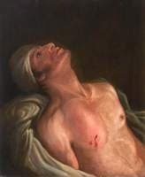 The Wounded following the Battle of Corunna: Gunshot Wound of Scapula
