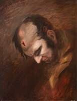 The Wounded following the Battle of Corunna: Musket Ball Wound of Head
