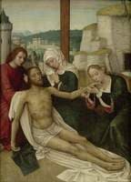 The Deposition