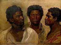Three Views of the Head of a Native, Madagascar